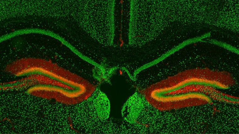 Fluorescently labelled mossy fiber pathway in the mouse hippocampus