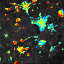 An image showing representative flashes of signal from a potentiometric dye in hiPSC-derived atrial cardiomyocytes.